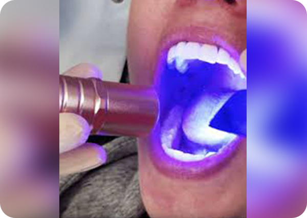 Oral Cancer Screening (OralID)