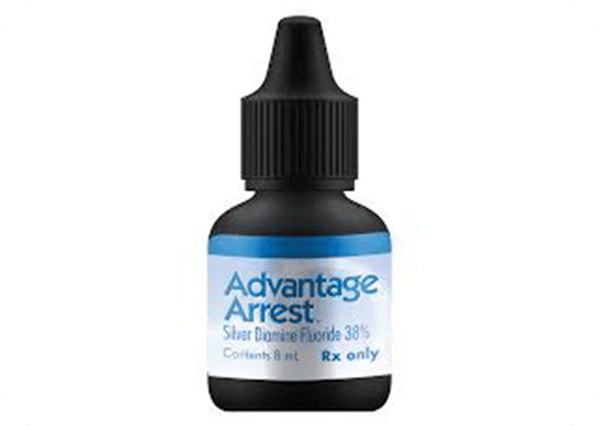Silver Diamine Fluoride (Cavity Reversal) 